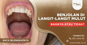 benjolan di langit-langit mulut, bahayakah?