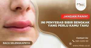 penyebab bibir bengkak