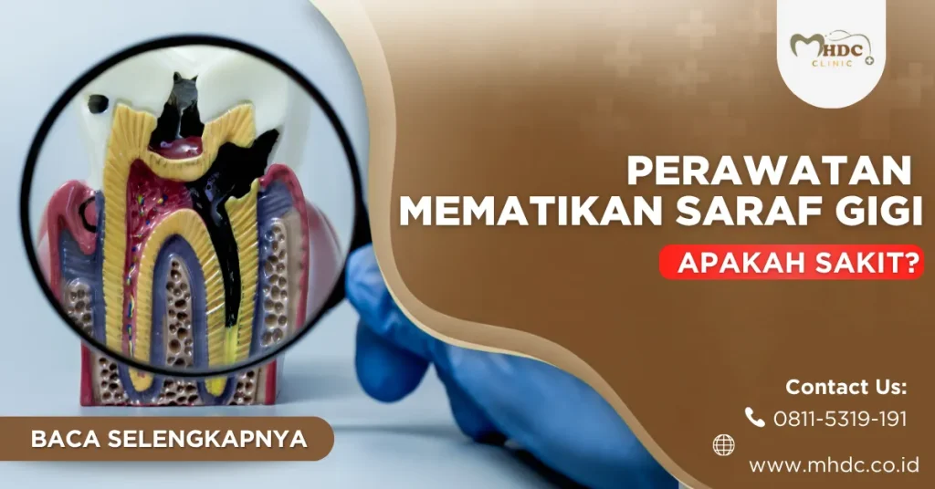 perawatan mematikan saraf gigi banner