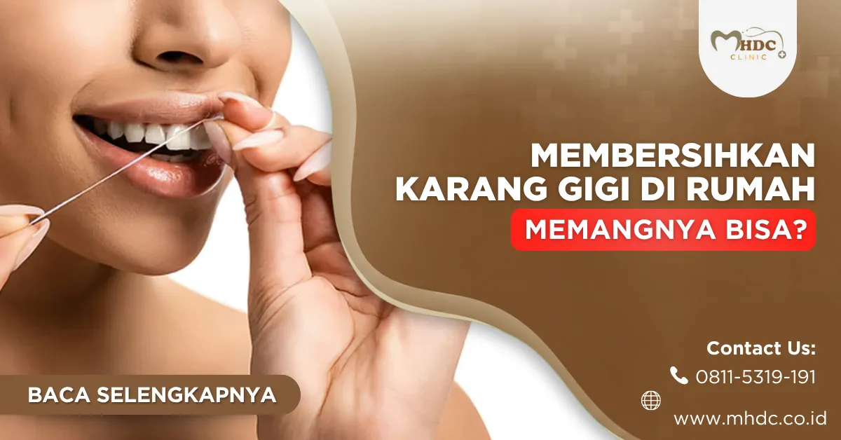 cara membersihkan karang gigi di rumah