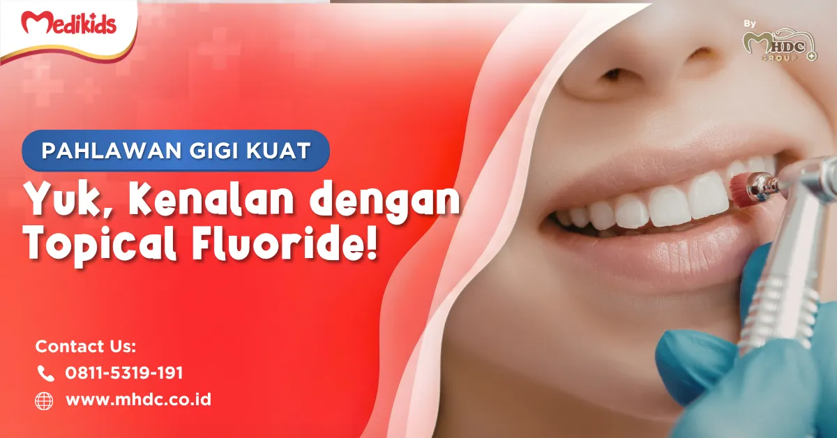 pemberian topical fluoride