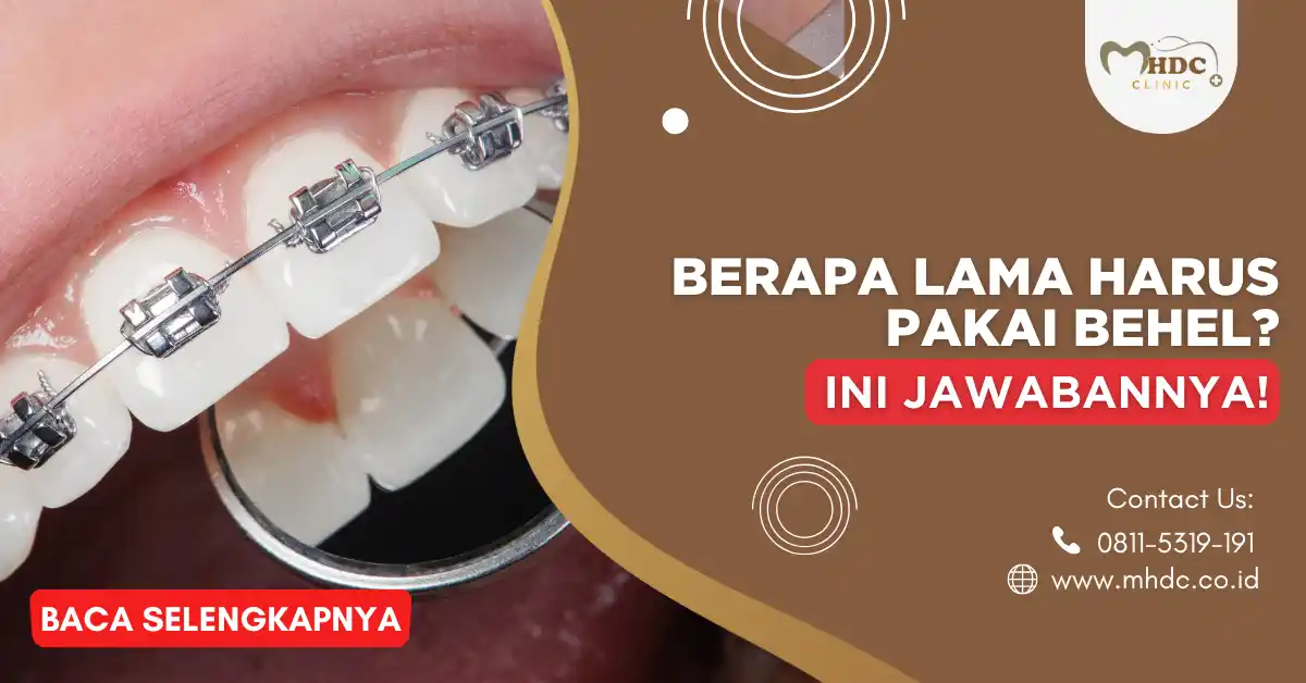 behel ortho