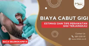 biaya cabut gigi