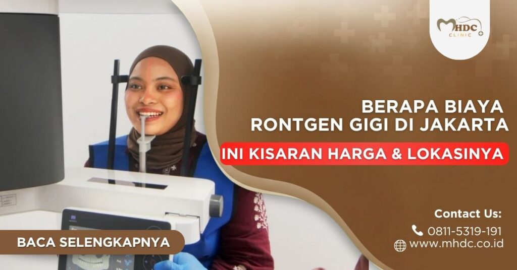 berapa biaya rontgen gigi di jakarta
