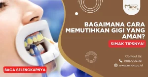 bagaimana cara memutihkan gigi