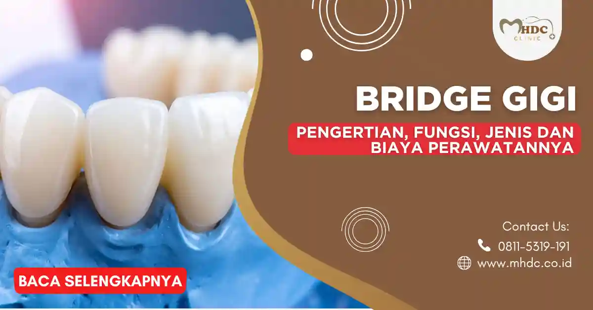 bridge adalah