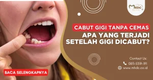 kondisi setelah gigi dicabut