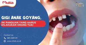 cara mencabut gigi anak yang sudah goyang