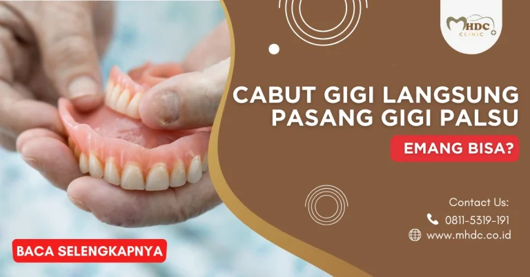 Cabut Gigi Langsung Pasang Gigi Palsu, Emang Bisa?