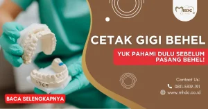 cetak gigi behel