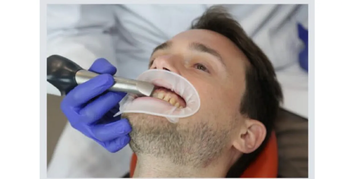 digital intraoral scanner