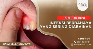 Cover bisul di gusi