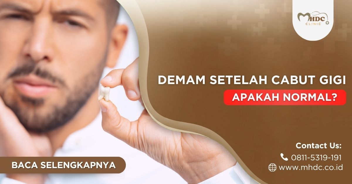 demam setelah cabut gigi apakah normal?