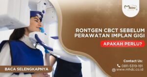 rontgen CBCT sebelum implan gigi