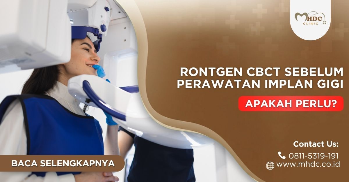rontgen CBCT sebelum implan gigi