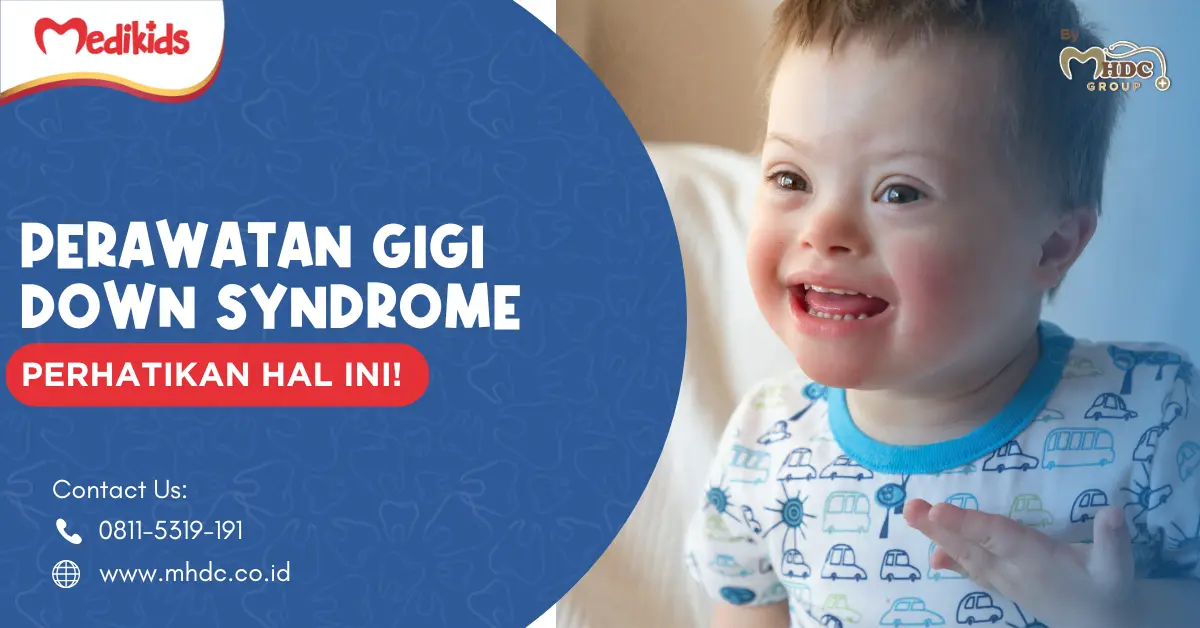 down syndrome adalah