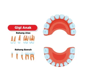 gigi susu anak