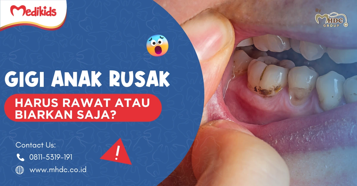 gigi anak rusak