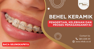 behel keramik