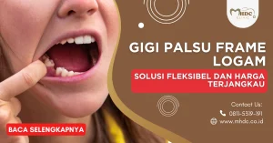 gigi palsu logam