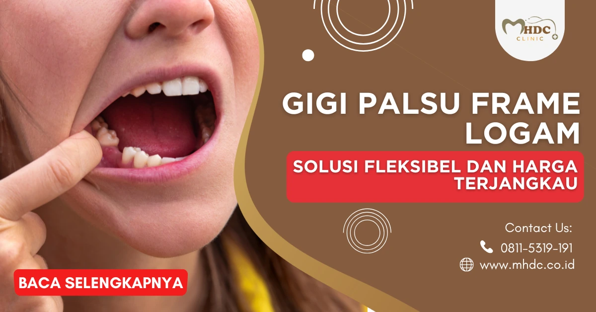 gigi palsu logam