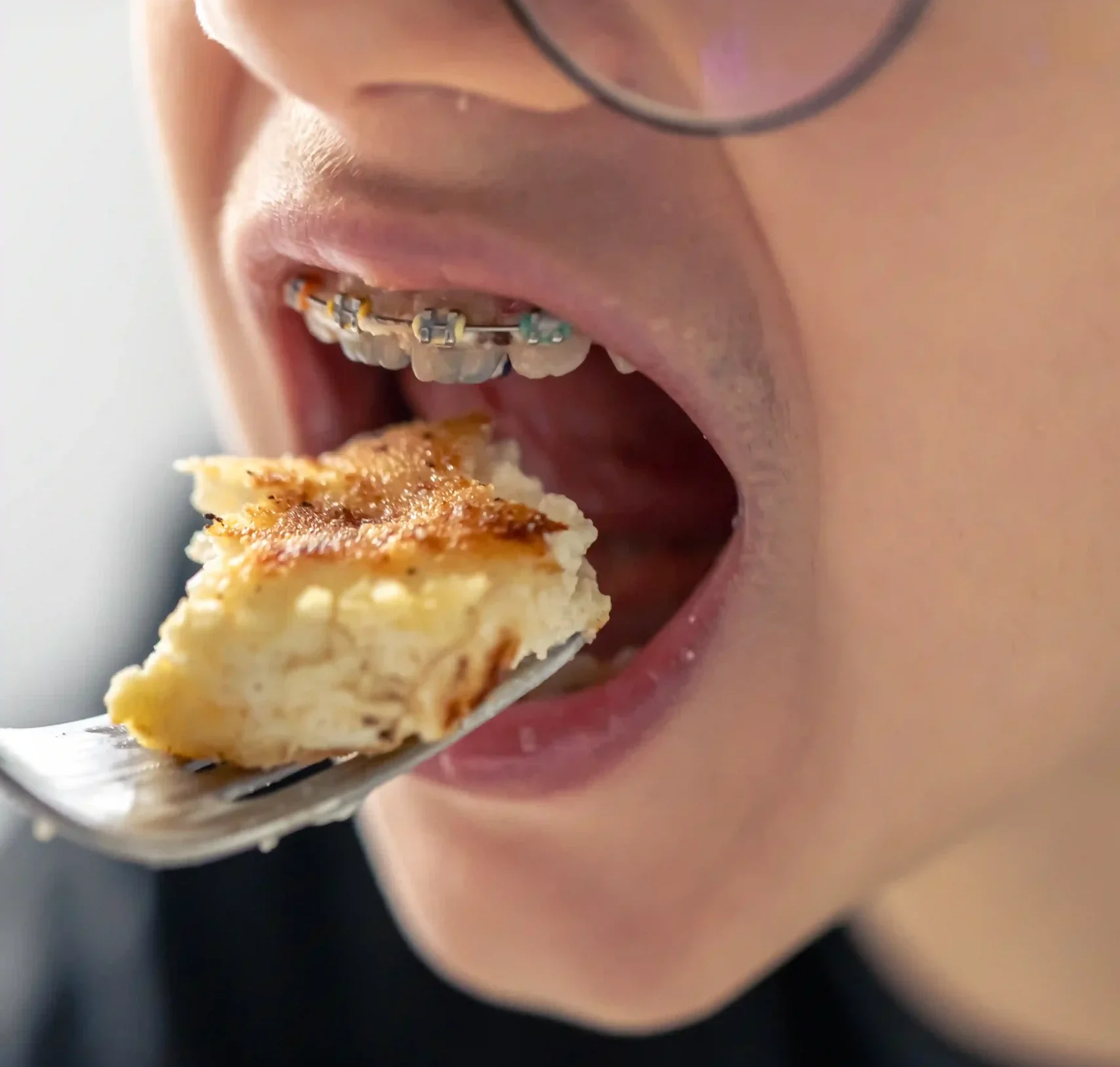 karang gigi di behel