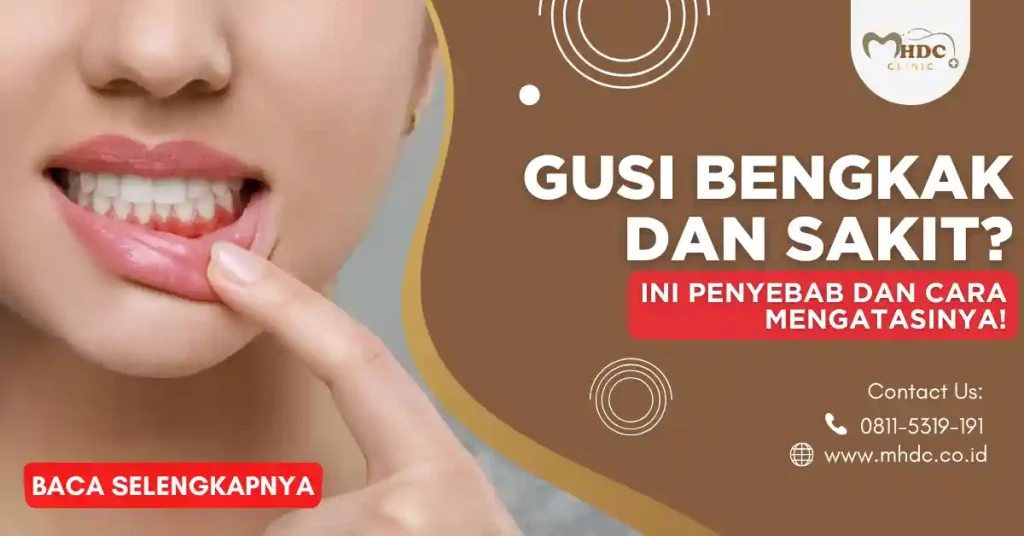 penyebab gusi bengkak dan sakit
