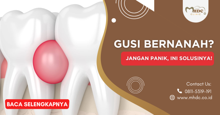 Gusi Bernanah? Jangan Panik, Ini Solusinya