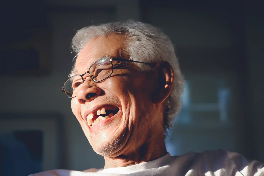 gigi ompong