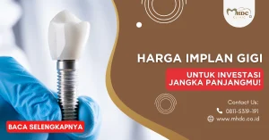 harga implan gigi