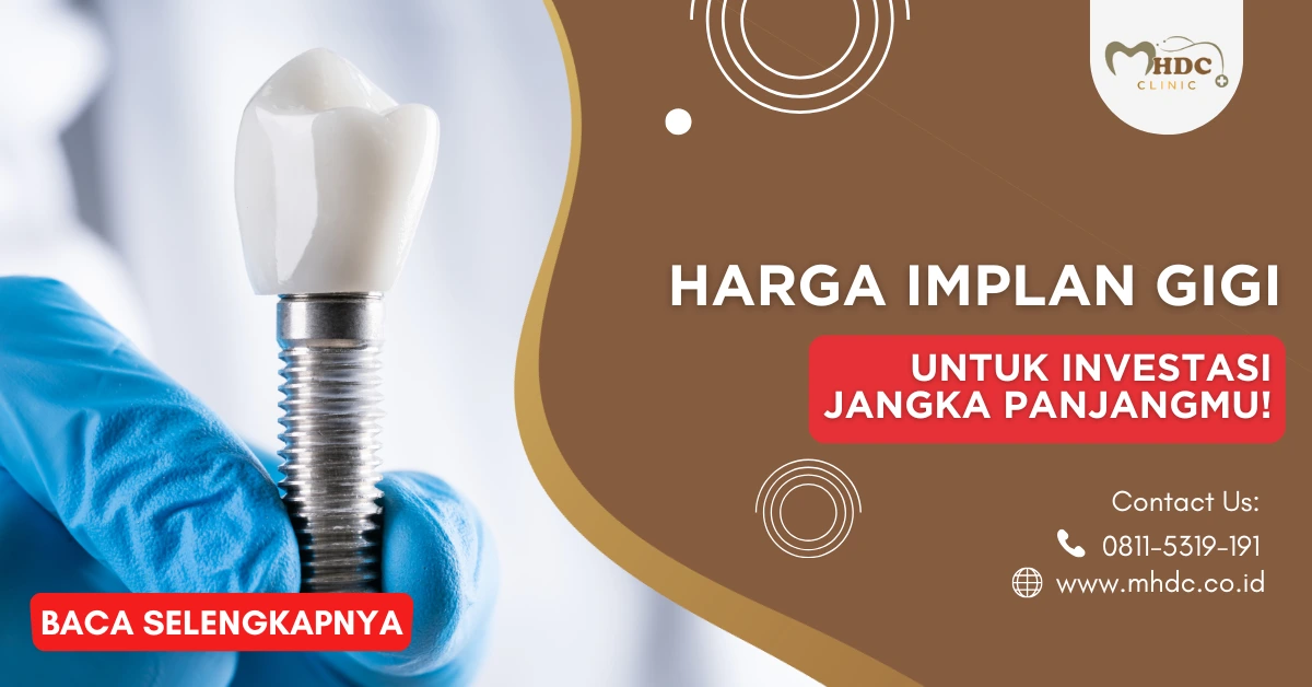 harga implan gigi