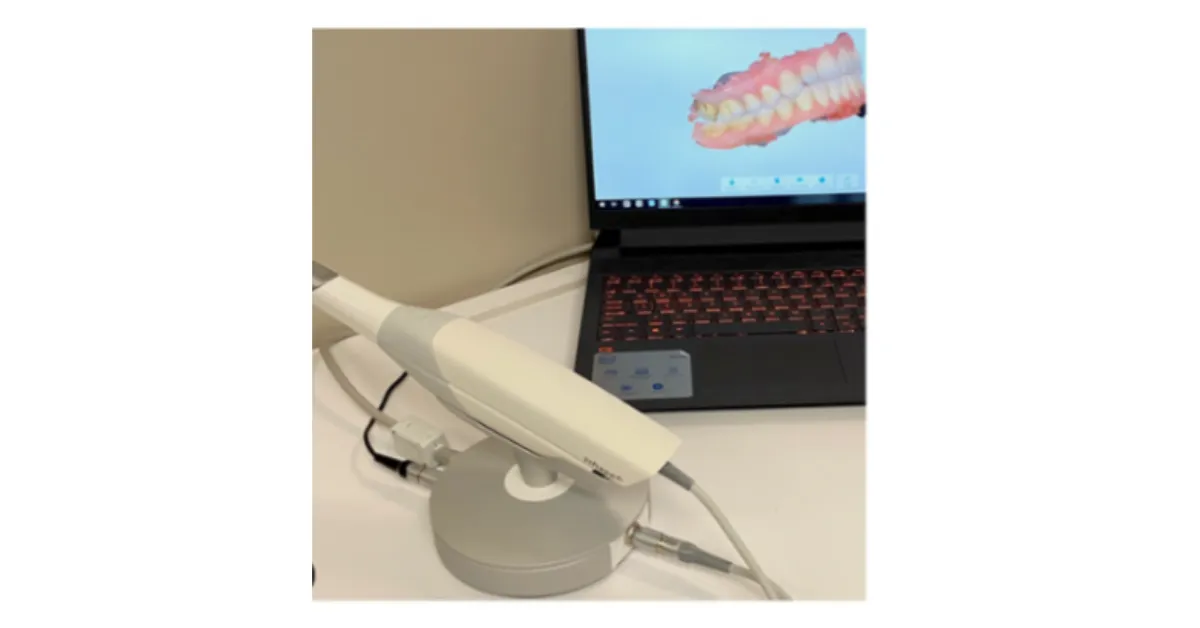digital intraoral scanner