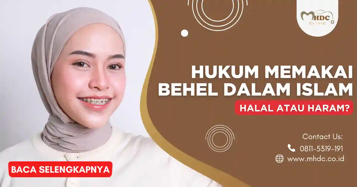 hukum memakai behel dalam islam