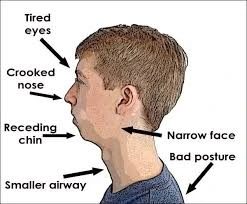 mengapa bernafas melalui hidung lebih baik daripada melalui mulut
