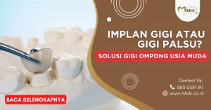 pasang implan gigi