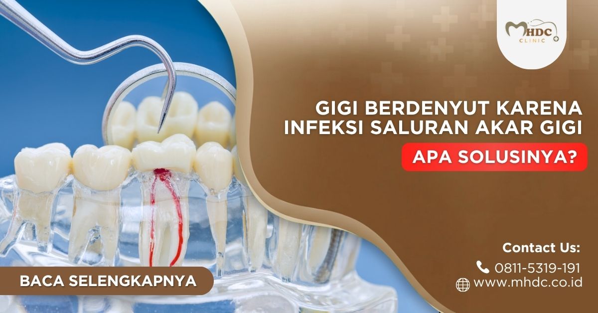 gigi berdenyut karena infeksi saluran akar gigi