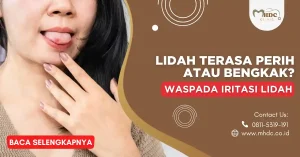 iritasi lidah