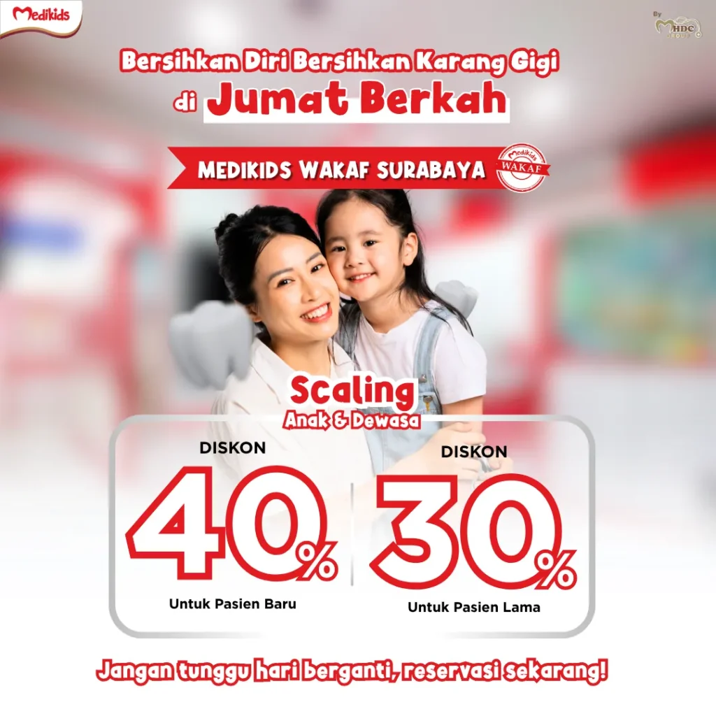 promo scaling di surabaya