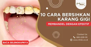 bersihkan karang gigi