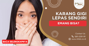 karang gigi lepas sendiri