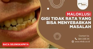 maloklusi adalah