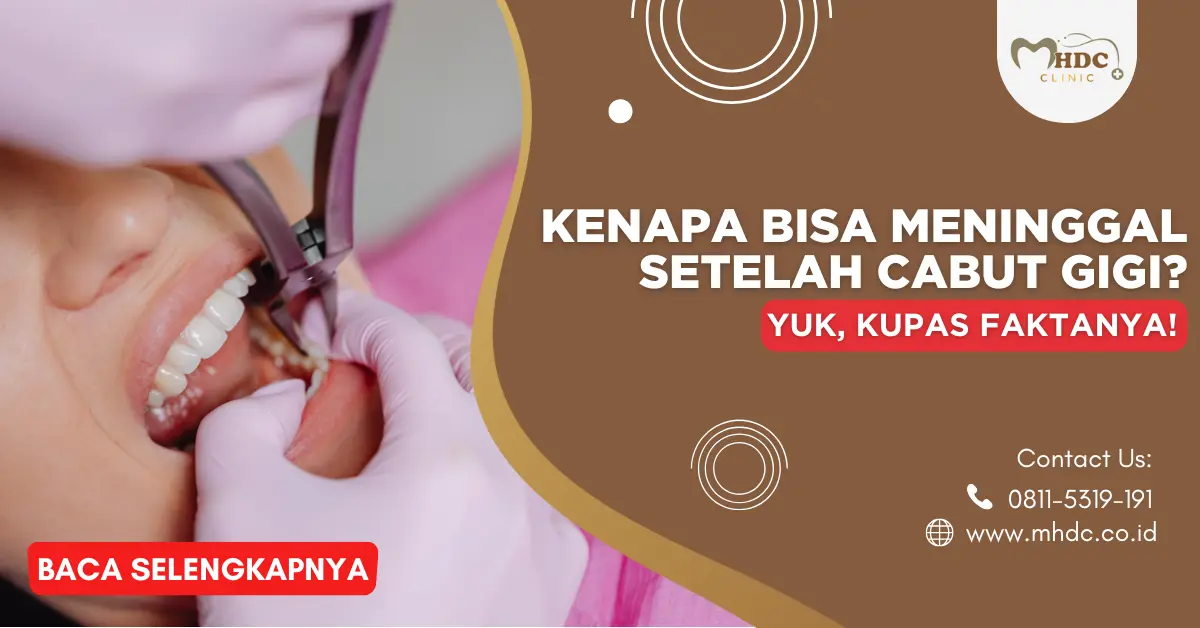 meninggal cabut gigi