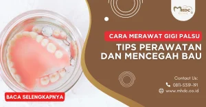 cara merawat gigi palsu permanen