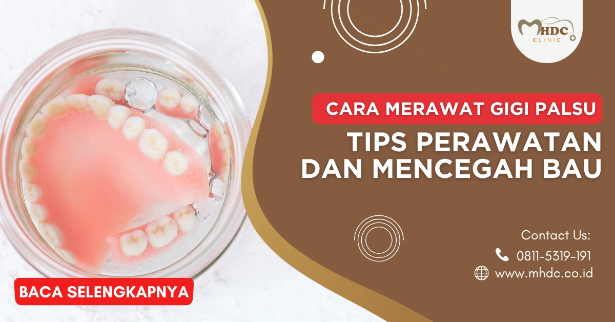 cara merawat gigi palsu permanen