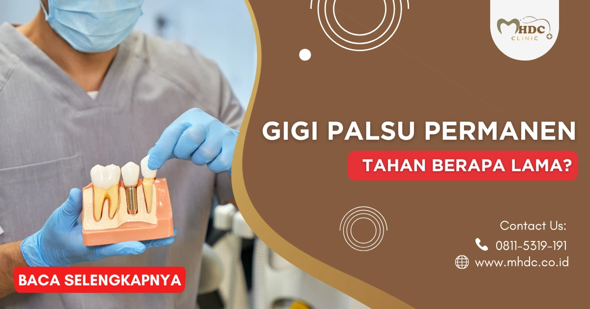 gigi palsu permanen