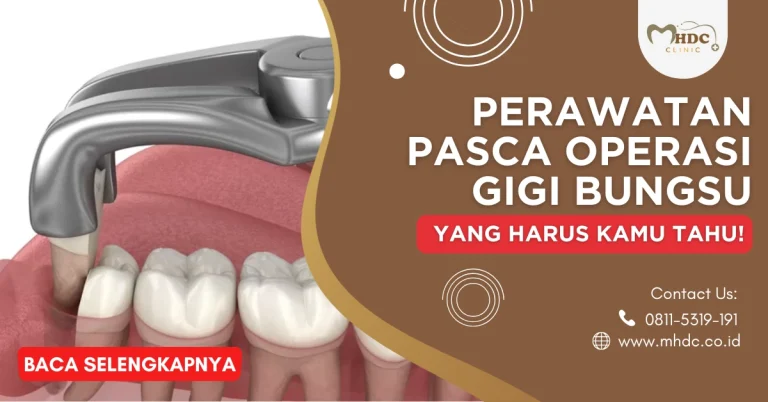 Perawatan Pasca Operasi Gigi Bungsu yang Harus Kamu Tahu!
