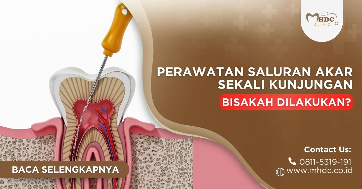 bisakah PSA gigi satu kali kunjungan