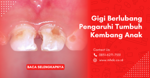 pola makan dan pengaruh gigi keropos