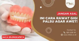 rawat gigi palsu