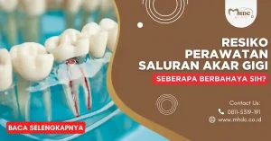 resiko perawatan akar gigi